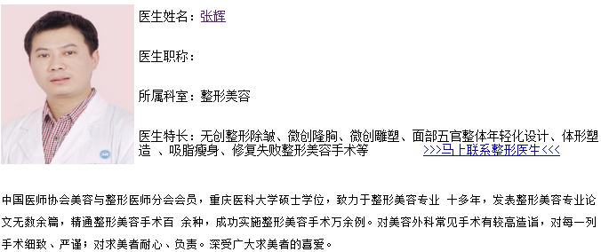 张辉